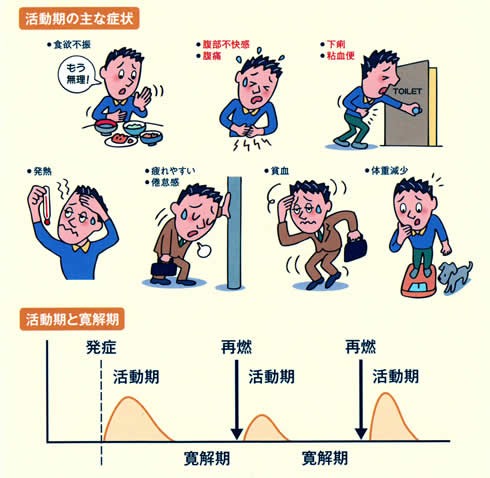 炎 死亡 潰瘍 率 大腸 性