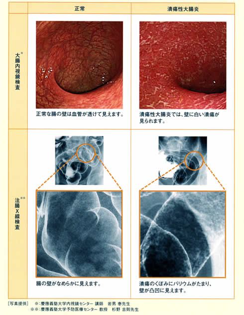 画像検査