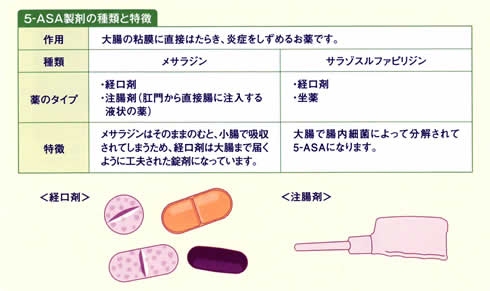 薬物治療の基本は5-アミノサリチル酸（5-ASA）製剤です。