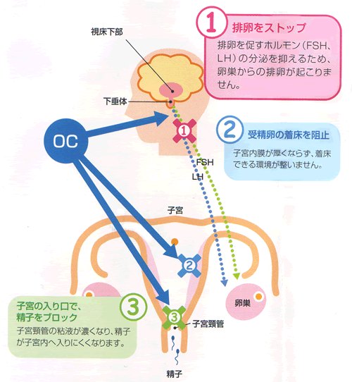 ピル 仕組み アフター