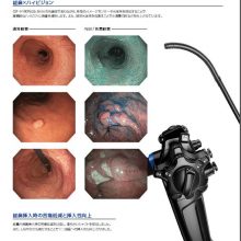 オリンパス最新式ハイビジョン経鼻内視鏡システムGIF-H190Nを導入しております。